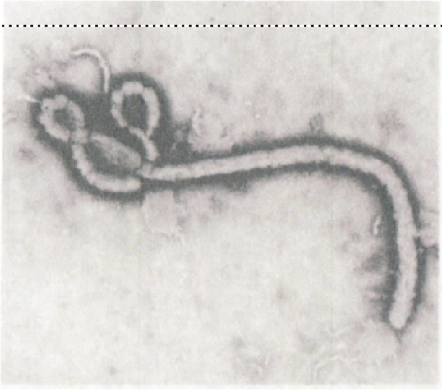 「エボラ出血熱」も歯医者で感染