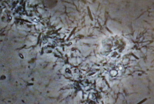 Treponema denticola（Ｔ.d菌）